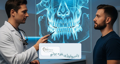CBCT