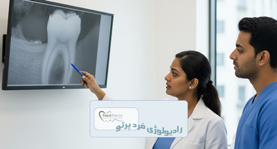 رادیوگرافی پری اپیکال