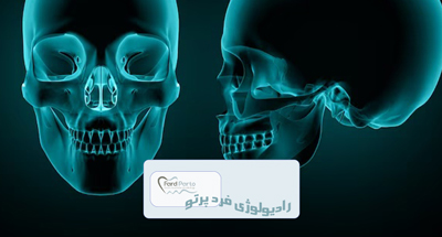 رادیوگرافی سفالوگرام چیست و چرا در ارتودنسی استفاده می‌شود؟