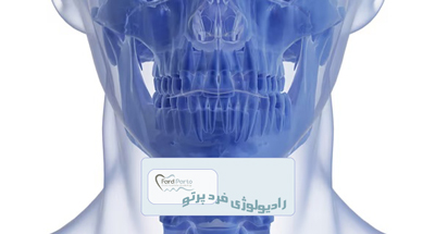 CBCT و نقش آن در تشخیص دقیق دندان‌ها و فک
