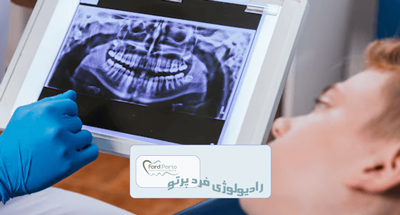 رادیوگرافی پانورکس و کاربردهای آن در دندانپزشکی و فک