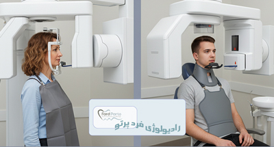 میزان اشعه رادیوگرافی های دندانپزشکی چقدر است؟