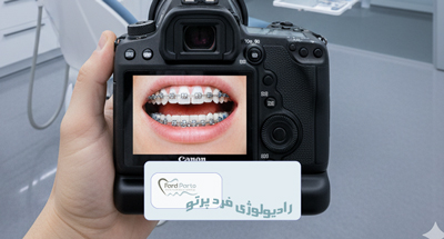 فوتوگرافی
