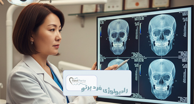 CBCT